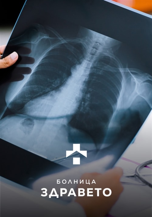 Умен рентген и ехография – Болница Здравето